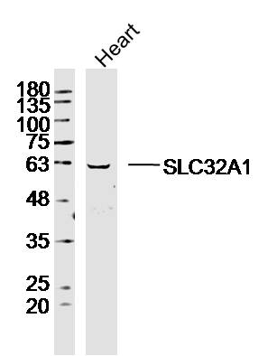 Mouse heart lysates probed with SLC32A1 Polyclonal Antibody, Unconjugated (bs-19821R) at 1:300 dilution and 4˚C overnight incubation. Followed by conjugated secondary antibody incubation at 1:10000 for 60 min at 37˚C.