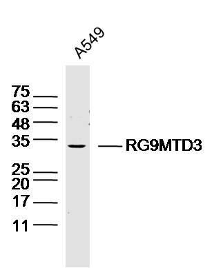 A549 lysates probed with RG9MTD3 Polyclonal Antibody, Unconjugated (bs-19845R) at 1:300 dilution and 4˚C overnight incubation. Followed by conjugated secondary antibody incubation at 1:10000 for 60 min at 37˚C.
