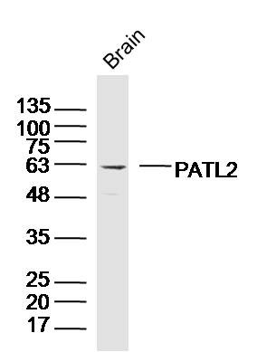 Mouse brain lysates probed with PATL2 Polyclonal Antibody, Unconjugated (bs-19898R) at 1:300 dilution and 4˚C overnight incubation. Followed by conjugated secondary antibody incubation at 1:10000 for 60 min at 37˚C.
