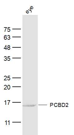 Ray eye lysates probed with PCBD2 Polyclonal Antibody, Unconjugated (bs-19906R) at 1:300 dilution and 4˚C overnight incubation. Followed by conjugated secondary antibody incubation at 1:10000 for 60 min at 37˚C.