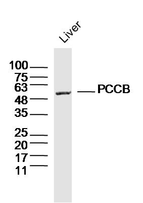 Mouse liver lysates probed with PCCB Polyclonal Antibody, Unconjugated (bs-19910R) at 1:300 dilution and 4˚C overnight incubation. Followed by conjugated secondary antibody incubation at 1:10000 for 60 min at 37˚C.