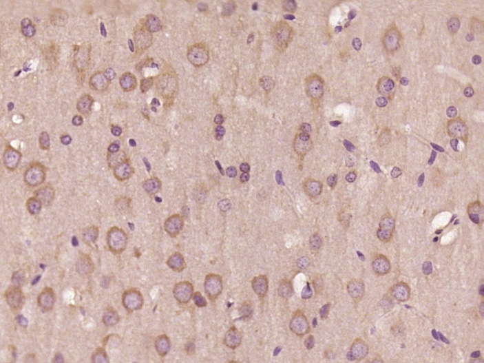 Paraformaldehyde-fixed, paraffin embedded Rat brain; Antigen retrieval by boiling in sodium citrate buffer (pH6.0) for 15min; Block endogenous peroxidase by 3% hydrogen peroxide for 20 minutes; Blocking buffer (normal goat serum) at 37°C for 30min; Antibody incubation with TRIM23 Polyclonal Antibody, Unconjugated (bs-20285R) at 1:500 overnight at 4°C, DAB staining.