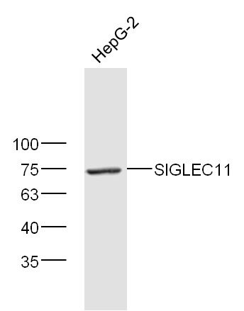 Hepg2 lysates probed with SIGLEC11 Polyclonal Antibody, Unconjugated (bs-20001R) at 1:300 dilution and 4˚C overnight incubation. Followed by conjugated secondary antibody incubation at 1:10000 for 60 min at 37˚C.