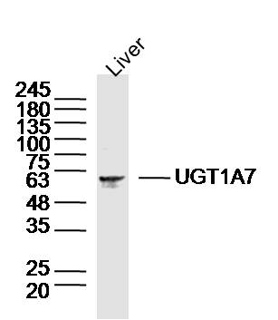 Mouse liver lysates probed with UGT1A7 Polyclonal Antibody, Unconjugated (bs-20068R) at 1:300 dilution and 4˚C overnight incubation. Followed by conjugated secondary antibody incubation at 1:10000 for 60 min at 37˚C.