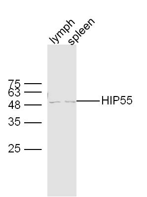 Lane 1: mouse lymph lysates; Lane 2: mouse spleen lysates probed with HIP55 Polyclonal Antibody, Unconjugated (bs-20165R) at 1:300 dilution and 4˚C overnight incubation. Followed by conjugated secondary antibody incubation at 1:10000 for 60 min at 37˚C.