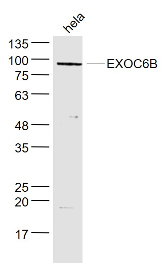 hela lysates probed with EXOC6B Polyclonal Antibody, Unconjugated (bs-14663R) at 1:300 dilution and 4˚C overnight incubation. Followed by conjugated secondary antibody incubation at 1:10000 for 60 min at 37˚C.