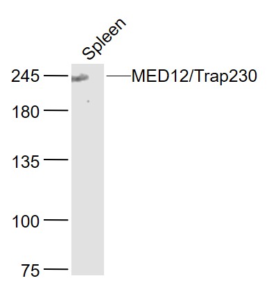 Mouse spleen lysates probed with MED12/Trap230 Polyclonal Antibody, Unconjugated (bs-18763R) at 1:300 dilution and 4˚C overnight incubation. Followed by conjugated secondary antibody incubation at 1:10000 for 60 min at 37˚C.