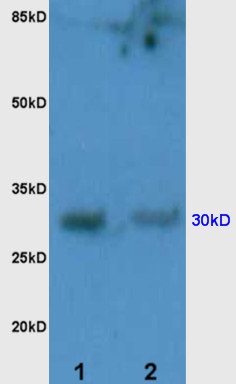 L1 human kidney lysates L2 rat brain lysates probed with Anti PD-1/CD279 Polyclonal Antibody, Unconjugated (bs-1867R) at 1:200 overnight at 4˚C. Followed by conjugation to secondary antibody (bs-0295G-HRP) at 1:3000 for 90 min at 37˚C. Predicted band 30kD. Observed band size:30kD.\n