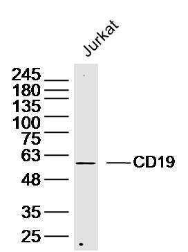 Jurkat lysates probed with CD19 Polyclonal Antibody, Unconjugated (bs-20782R) at 1:300 dilution and 4˚C overnight incubation. Followed by conjugated secondary antibody incubation at 1:10000 for 60 min at 37˚C.