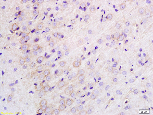 Formalin-fixed and paraffin embedded rat brain labeled with Anti-TLR1 Polyclonal Antibody, Unconjugated (bs-1919R) at 1:200 followed by conjugation to the secondary antibody and DAB staining.