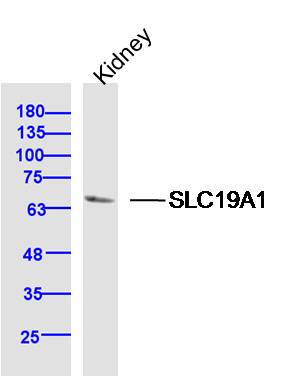 Mouse Kidney lysates probed with SLC19A1 Polyclonal Antibody, Unconjugated (bs-20879R) at 1:300 dilution and 4˚C overnight incubation. Followed by conjugated secondary antibody incubation at 1:10000 for 60 min at 37˚C.