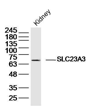 Mouse kidney lysates probed with SLC23A3 Polyclonal Antibody, Unconjugated (bs-20881R) at 1:300 dilution and 4˚C overnight incubation. Followed by conjugated secondary antibody incubation at 1:10000 for 60 min at 37˚C.