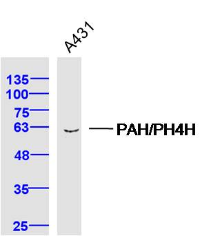 A431 lysates probed with PAH/PH4H Polyclonal Antibody, Unconjugated (bs-21005R) at 1:300 dilution and 4˚C overnight incubation. Followed by conjugated secondary antibody incubation at 1:10000 for 60 min at 37˚C.