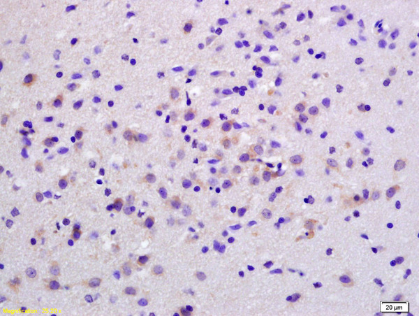 Formalin-fixed and paraffin embedded rat brain labeled with Anti-S100B Polyclonal Antibody, Unconjugated (bs-2015R) at 1:200 followed by conjugation to the secondary antibody and DAB staining.