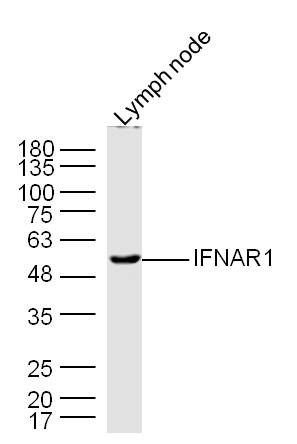 Mouse lymph node lysates probed with IFNAR1 Polyclonal Antibody, Unconjugated (bs-4116R) at 1:300 dilution and 4˚C overnight incubation. Followed by conjugated secondary antibody incubation at 1:10000 for 60 min at 37˚C.
