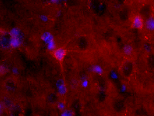 Formalin-fixed and paraffin-embedded rat brain labeled with Anti-S100B Polyclonal Antibody, Unconjugated(bs-2015R) 1:200, overnight at 4°C, The secondary antibody was Goat Anti-Rabbit IgG, PE conjugated(bs-0295G-PE)used at 1:200 dilution for 40 minutes at 37°C.