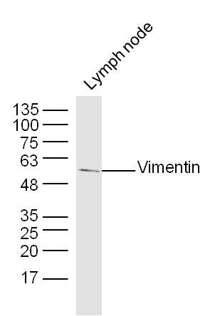 Lymph node lysates probed with Vimentin Polyclonal Antibody, Unconjugated (bs-8533R) at 1:300 dilution and 4˚C overnight incubation. Followed by conjugated secondary antibody incubation at 1:10000 for 60 min at 37˚C. 