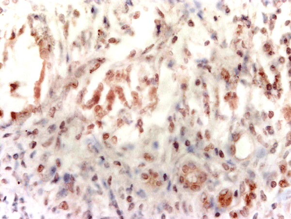 Formalin-fixed and paraffin embedded rat kidney labeled with Anti-AQP7 Polyclonal Antibody, Unconjugated (bs-2506R) at 1:200, followed by conjugation to the secondary antibody and DAB staining