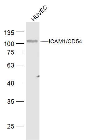 HUVEC lysates probed with ICAM1/CD54 Polyclonal Antibody, Unconjugated (bs-10697M) at 1:300 dilution and 4˚C overnight incubation. Followed by conjugated secondary antibody incubation at 1:10000 for 60 min at 37˚C.