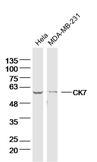 Lane 1: Hela lysates; Lane 2: MDA-MB-231 lysates probed with CK7 Polyclonal Antibody, Unconjugated (bs-33060M) at 1:300 dilution and 4˚C overnight incubation. Followed by conjugated secondary antibody incubation at 1:10000 for 60 min at 37˚C.