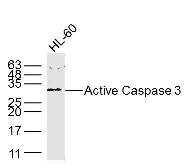 HL60 lysates probed with Active Caspase 3 Polyclonal Antibody, Unconjugated (bs-33199M) at 1:300 dilution and 4˚C overnight incubation. Followed by conjugated secondary antibody incubation at 1:10000 for 60 min at 37˚C.