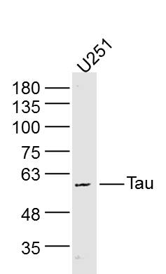U251 lysates probed with Tau Polyclonal Antibody, Unconjugated (bs-33332M) at 1:300 dilution and 4˚C overnight incubation. Followed by conjugated secondary antibody incubation at 1:10000 for 60 min at 37˚C.
