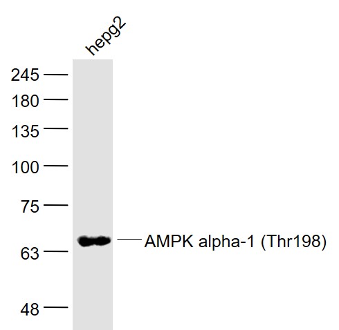 AMPK alpha 1 Thr198 Antibody Bioss