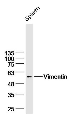 Mouse spleen lysates probed with Vimentin Polyclonal Antibody, Unconjugated (bs-23064R) at 1:300 dilution and 4˚C overnight incubation. Followed by conjugated secondary antibody incubation at 1:10000 for 60 min at 37˚C. 