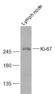 Mouse lymph node lysates probed with Ki-67 Polyclonal Antibody, Unconjugated (bs-23102R) at 1:300 dilution and 4˚C overnight incubation. Followed by conjugated secondary antibody incubation at 1:10000 for 60 min at 37˚C. Mouse lymph node lysates probed with Ki-67 Polyclonal Antibody, Unconjugated (bs-23102R) at 1:300 dilution and 4˚C overnight incubation. Followed by conjugated secondary antibody incubation at 1:10000 for 60 min at 37˚C.