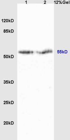 Lane 1: Liver lysates; Lane 2: Brain lysates probed with Cyp2-j3 Polyclonal Antibody, Unconjugated (bs-2123R) at 1:300 dilution and 4˚C overnight incubation. Followed by conjugated secondary antibody incubation at 1:10000 for 60 min at 37˚C. Lane 1: Liver lysates; Lane 2: Brain lysates probed with Cyp2-j3 Polyclonal Antibody, Unconjugated (bs-2123R) at 1:300 dilution and 4˚C overnight incubation. Followed by conjugated secondary antibody incubation at 1:10000 for 60 min at 37˚C.