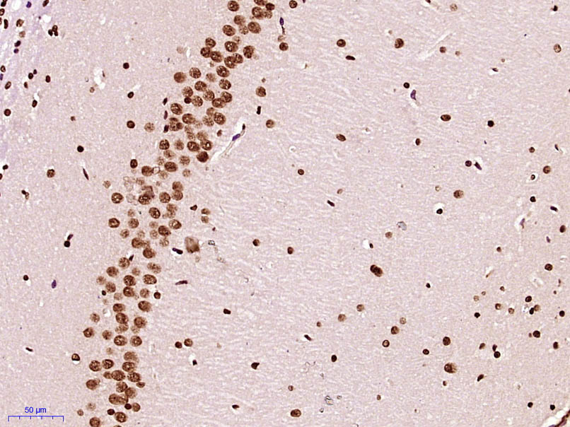 Paraformaldehyde-fixed, paraffin embedded Rat brain; Antigen retrieval by boiling in sodium citrate buffer (pH6.0) for 15min; Block endogenous peroxidase by 3% hydrogen peroxide for 20 minutes; Blocking buffer (normal goat serum) at 37°C for 30min; Antibody incubation with Histone H3 (di methyl K79) Monoclonal Antibody, Unconjugated (bsm-33093M) at 1:400 overnight at 4°C, DAB staining.