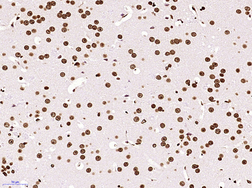 Paraformaldehyde-fixed, paraffin embedded Mouse brain; Antigen retrieval by boiling in sodium citrate buffer (pH6.0) for 15min; Block endogenous peroxidase by 3% hydrogen peroxide for 20 minutes; Blocking buffer (normal goat serum) at 37°C for 30min; Antibody incubation with Histone H3 (di methyl K79) Monoclonal Antibody, Unconjugated (bsm-33093M) at 1:400 overnight at 4°C, DAB staining.