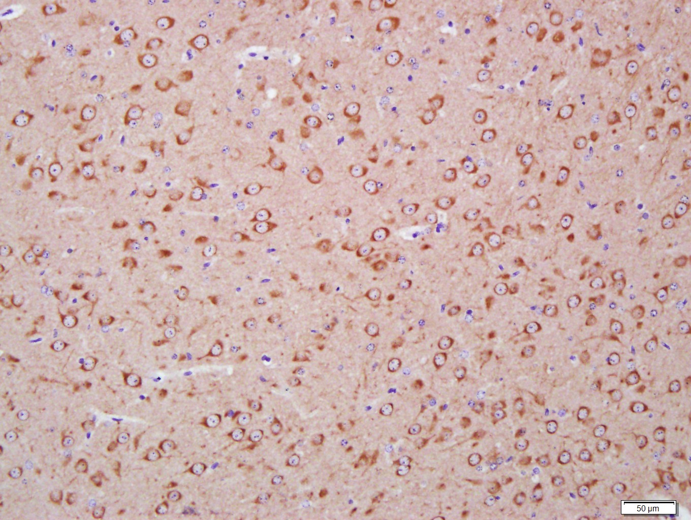 Paraformaldehyde-fixed, paraffin embedded mouse brain; Antigen retrieval by boiling in sodium citrate buffer (pH6.0) for 15min; Block endogenous peroxidase by 3% hydrogen peroxide for 20 minutes; Blocking buffer (normal goat serum) at 37°C for 30min; Antibody incubation with LC3A Monoclonal Antibody, Unconjugated (bsm-33309M) at 1:400 overnight at 4°C, DAB staining.