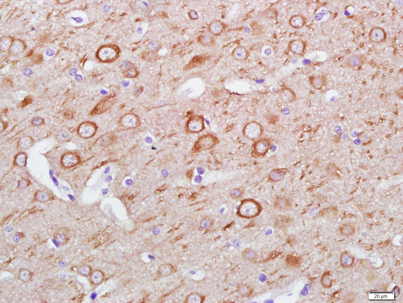 Paraformaldehyde-fixed, paraffin embedded Rat brain; Antigen retrieval by boiling in sodium citrate buffer (pH6.0) for 15min; Block endogenous peroxidase by 3% hydrogen peroxide for 20 minutes; Blocking buffer (normal goat serum) at 37°C for 30min; Antibody incubation with LC3A Monoclonal Antibody, Unconjugated (bsm-33309M) at 1:400 overnight at 4°C, DAB staining.