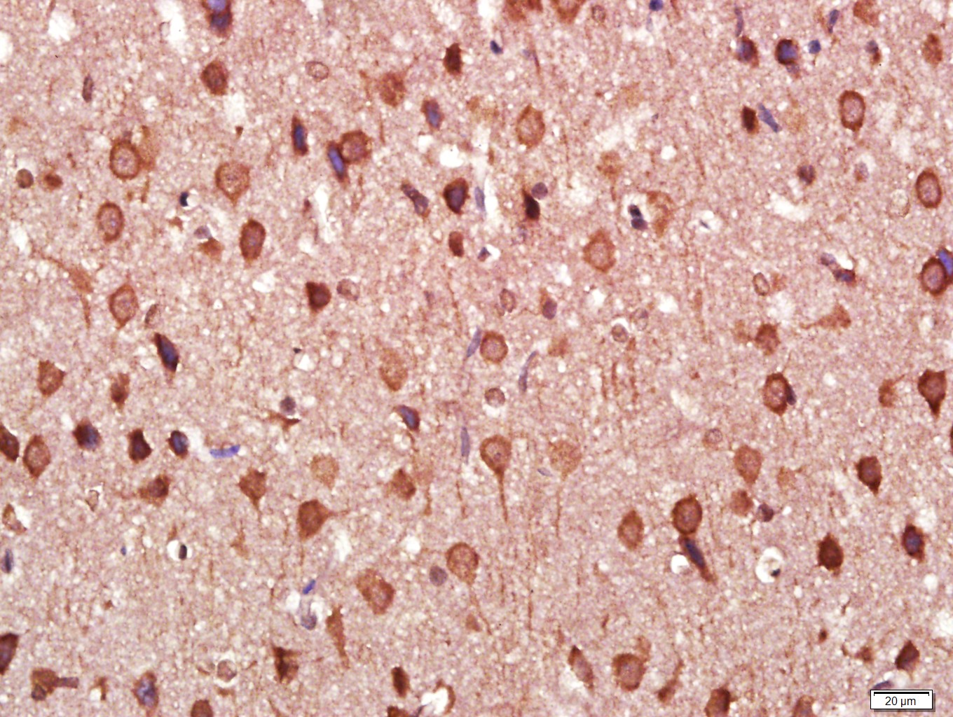 Paraformaldehyde-fixed, paraffin embedded Rat brain; Antigen retrieval by boiling in sodium citrate buffer (pH6.0) for 15min; Block endogenous peroxidase by 3% hydrogen peroxide for 20 minutes; Blocking buffer (normal goat serum) at 37°C for 30min; Antibody incubation with Tau Monoclonal Antibody, Unconjugated (bsm-33332M) at 1:400 overnight at 4°C, DAB staining.