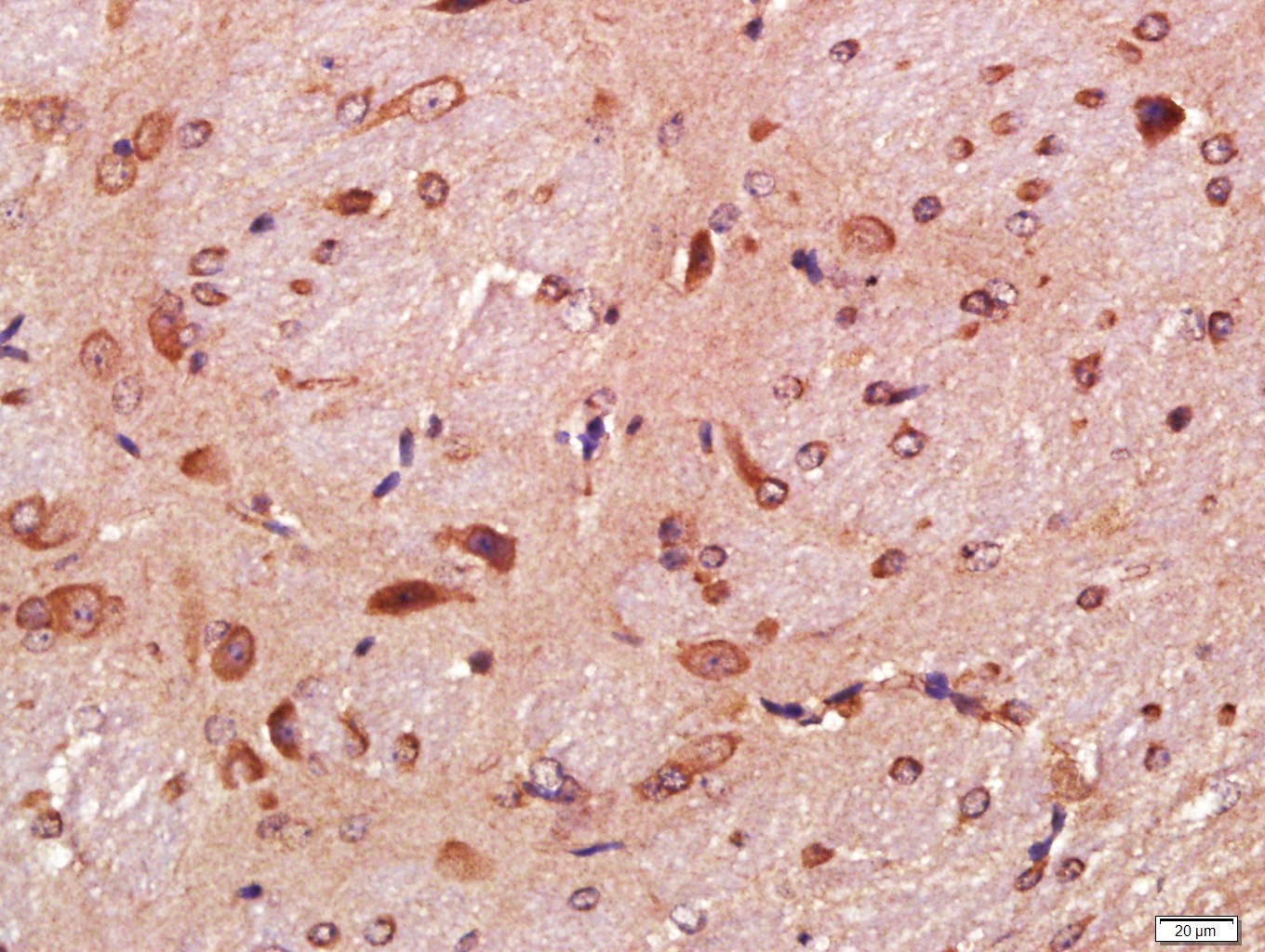 Paraformaldehyde-fixed, paraffin embedded Mouse brain; Antigen retrieval by boiling in sodium citrate buffer (pH6.0) for 15min; Block endogenous peroxidase by 3% hydrogen peroxide for 20 minutes; Blocking buffer (normal goat serum) at 37°C for 30min; Antibody incubation with Tau Monoclonal Antibody, Unconjugated (bsm-33332M) at 1:400 overnight at 4°C, DAB staining.