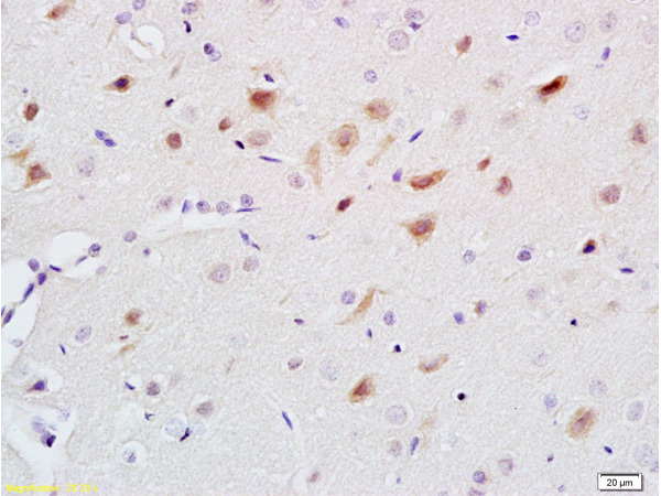 Formalin-fixed and paraffin embedded rat brain labeled with Anti-5-HT Polyclonal Antibody, Unconjugated (bs-2539R) at 1:200 followed by conjugation to the secondary antibody and DAB staining.