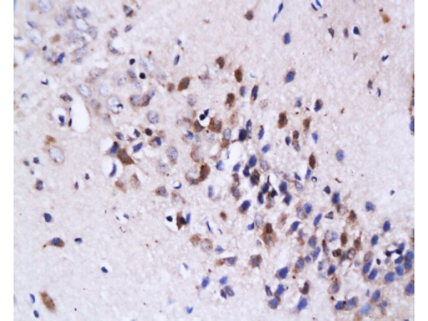 Formalin-fixed and paraffin embedded: rat brain tissue labeled with Anti-FasL Polyclonal Antibody, Unconjugated (bs-0216R) at 1:200, followed by conjugation to the secondary antibody and DAB staining