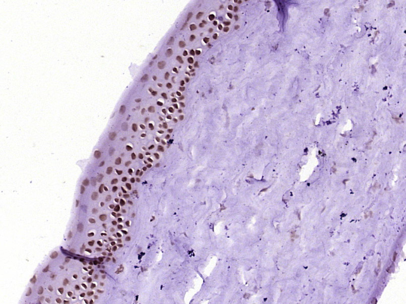 Paraformaldehyde-fixed, paraffin embedded Rat eye; Antigen retrieval by boiling in sodium citrate buffer (pH6.0) for 15min; Block endogenous peroxidase by 3% hydrogen peroxide for 20 minutes; Blocking buffer (normal goat serum) at 37°C for 30min; Antibody incubation with PITX3 Polyclonal Antibody, Unconjugated (bs-2364R) at 1:400 overnight at 4°C, DAB staining.