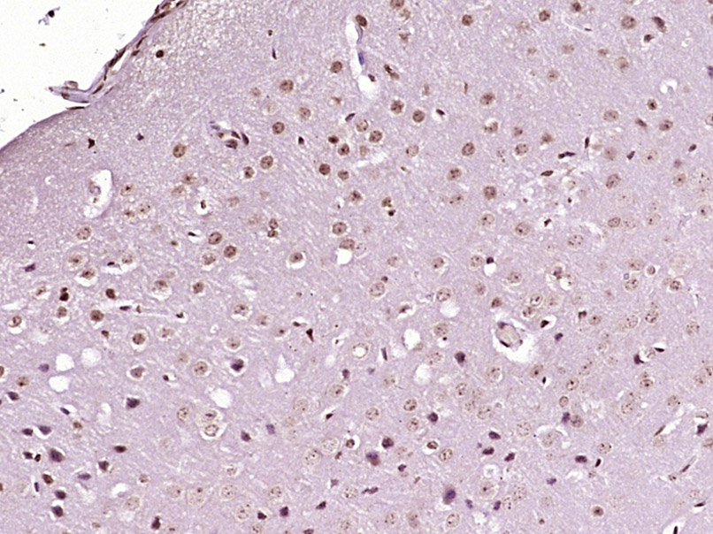 Paraformaldehyde-fixed, paraffin embedded Mouse brain; Antigen retrieval by boiling in sodium citrate buffer (pH6.0) for 15min; Block endogenous peroxidase by 3% hydrogen peroxide for 20 minutes; Blocking buffer (normal goat serum) at 37°C for 30min; Antibody incubation with PITX3 Polyclonal Antibody, Unconjugated (bs-2364R) at 1:400 overnight at 4°C, DAB staining.