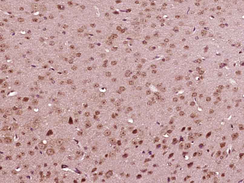 Paraformaldehyde-fixed, paraffin embedded Mouse brain; Antigen retrieval by boiling in sodium citrate buffer (pH6.0) for 15min; Block endogenous peroxidase by 3% hydrogen peroxide for 20 minutes; Blocking buffer (normal goat serum) at 37°C for 30min; Antibody incubation with BMAL1 Polyclonal Antibody, Unconjugated (bs-3750R) at 1:400 overnight at 4°C, DAB staining.
