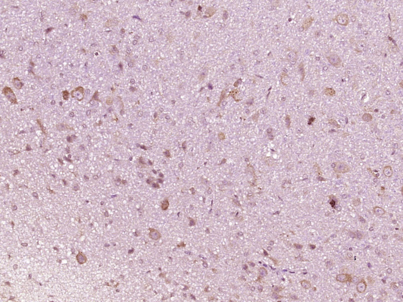 Paraformaldehyde-fixed, paraffin embedded Rat brain; Antigen retrieval by boiling in sodium citrate buffer (pH6.0) for 15min; Block endogenous peroxidase by 3% hydrogen peroxide for 20 minutes; Blocking buffer (normal goat serum) at 37°C for 30min; Antibody incubation with IFNAR1 Polyclonal Antibody, Unconjugated (bs-4116R) at 1:400 overnight at 4°C, DAB staining.