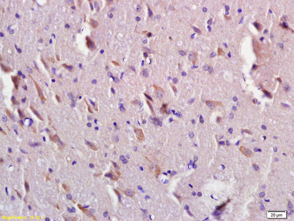 Formalin-fixed and paraffin-embedded rat brain labeled with CEMIP Polyclonal Antibody, Unconjugated (bs-8059R) at 1:200 followed by conjugation to the secondary antibody and DAB staining. Formalin-fixed and paraffin-embedded rat brain labeled with CEMIP Polyclonal Antibody, Unconjugated (bs-8059R) at 1:200 followed by conjugation to the secondary antibody and DAB staining.