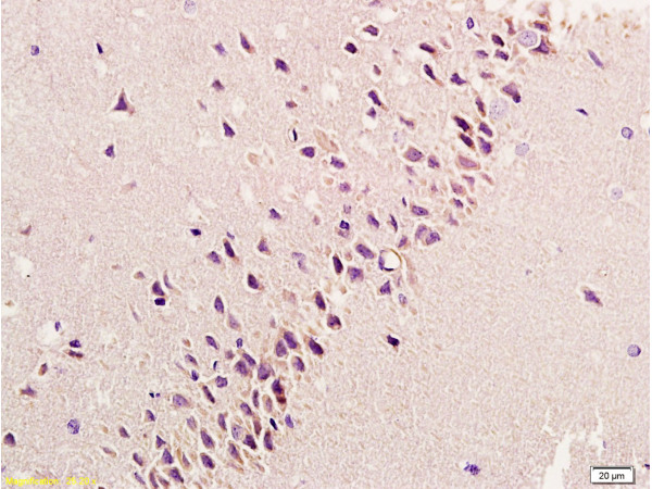 Formalin-fixed and paraffin embedded: rat brain tissue labeled with Anti-bFGF Polyclonal Antibody, Unconjugated (bs-0217R) at 1:200, followed by conjugation to the secondary antibody and DAB staining