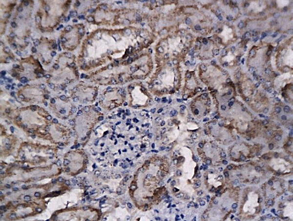 Formalin-fixed and paraffin embedded mouse kidney labeled with Anti-BFGF/FGF2 Polyclonal Antibody, Unconjugated (bs-0217R) followed by conjugation to the secondary antibody and DAB staining
