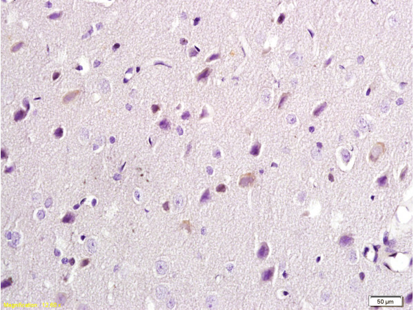 Formalin-fixed and paraffin embedded: rat brain tissue labeled with Anti-NR2B\/NMDAR2B Polyclonal Antibody, Unconjugated (bs-0222R) at 1:300, followed by conjugation to the secondary antibody and DAB staining
