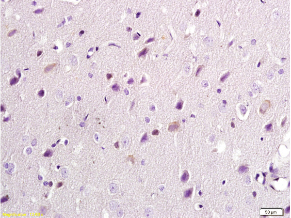 Formalin-fixed and paraffin embedded: rat brain tissue labeled with Anti-NR2B/NMDAR2B Polyclonal Antibody, Unconjugated (bs-0222R) at 1:300, followed by conjugation to the secondary antibody and DAB staining