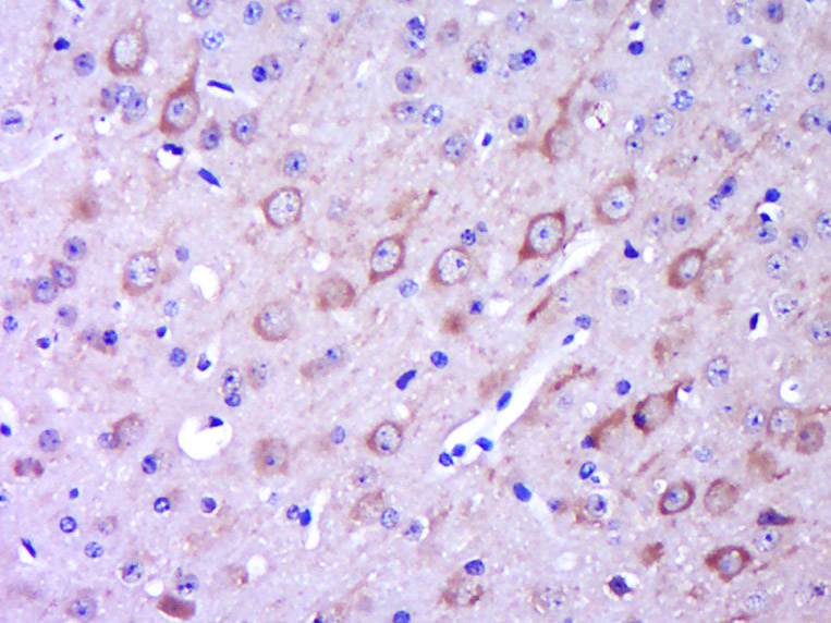 Paraformaldehyde-fixed, paraffin embedded Mouse brain; Antigen retrieval by boiling in sodium citrate buffer (pH6.0) for 15min; Block endogenous peroxidase by 3% hydrogen peroxide for 20 minutes; Blocking buffer (normal goat serum) at 37°C for 30min; Antibody incubation with GPR49/LGR5 Polyclonal Antibody, Unconjugated (bs-20746R) at 1:400 overnight at 4°C, DAB staining.