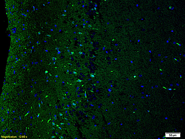 Formalin-fixed and paraffin embedded: : rat brain tissue labeled with Anti-NR2B\/NMDAR2B Polyclonal Antibody, Unconjugated (bs-0222R) at 1:200,, followed by conjugation to the secondary antibody was Goat Anti-Rabbit IgG, FITC conjugated(bs-0295G-FITC) at 1:200 for 40 minutes at 37\u00b0C and DAPI staining