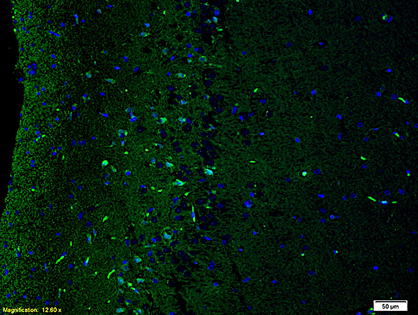 Formalin-fixed and paraffin embedded: : rat brain tissue labeled with Anti-NR2B/NMDAR2B Polyclonal Antibody, Unconjugated (bs-0222R) at 1:200,, followed by conjugation to the secondary antibody was Goat Anti-Rabbit IgG, FITC conjugated(bs-0295G-FITC) at 1:200 for 40 minutes at 37°C and DAPI staining